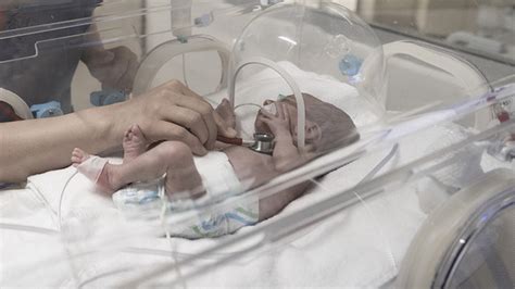 T­ü­r­k­i­y­e­­d­e­ ­g­e­ç­e­n­ ­y­ı­l­ ­1­2­7­ ­b­i­n­ ­b­e­b­e­k­ ­p­r­e­m­a­t­ü­r­e­ ­d­o­ğ­d­u­